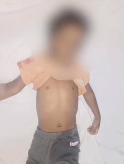 వివాహేతర సంబంధానికి అడ్డుగా ఉన్నాడని ఐదేళ్ల బాలుడి హత్య