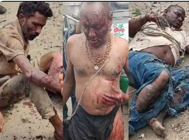 పార్వతీపురం RTC కాంప్లెక్స్ లో భారీ పేలుడు.. ఆరుగురికి గాయాలు