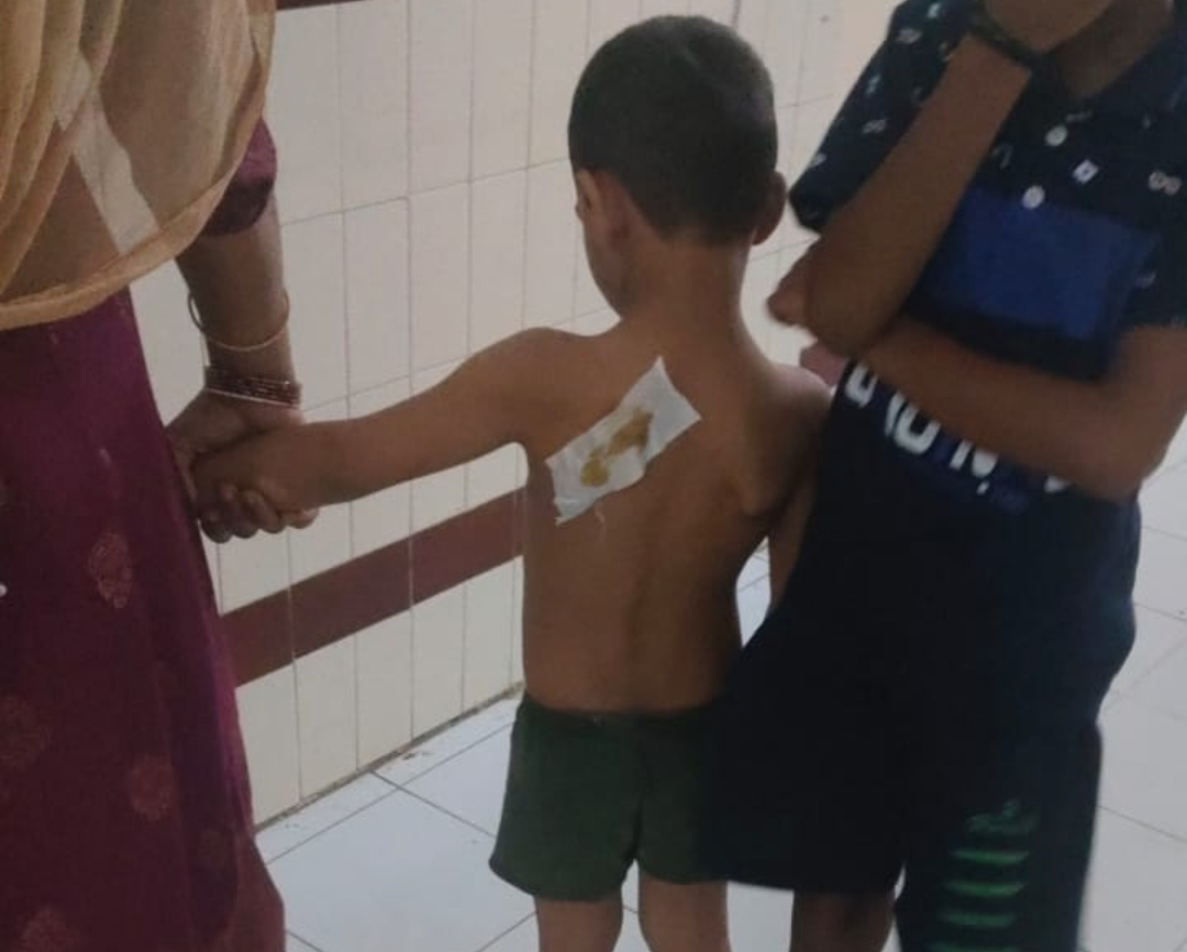 సిరిసిల్ల లోని పలు ప్రాంతాలలో సుమారు 30 మందికి పైగా మనుషులపై వీధి కుక్కల దాడి