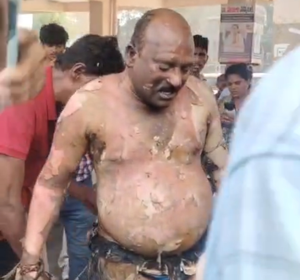 సమ్మె ఉద్రిక్తతల మధ్య ఆర్టీసీ డ్రైవర్ ఆత్మహత్యాయత్నం